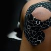 kinesiology tape theraband μαύρο λευκό 5 μέτρα εφαρμογή σε επιγονατίδα